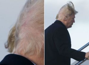 Ez lehet a magyarázat Donald Trump rémes frizurájára